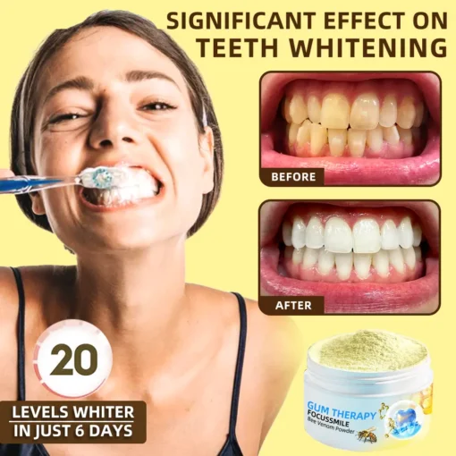 𝐎𝐲𝐢𝐤𝐞𝐲™ Focussmile Bee Venom Treatment Oral Powder