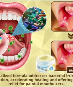 𝐎𝐲𝐢𝐤𝐞𝐲™ Focussmile Bee Venom Treatment Oral Powder