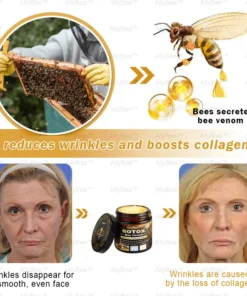 AllyBee™ Botox Bee Venom Wrinkle Removal Cream