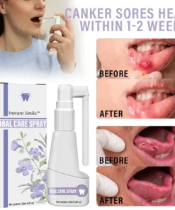 Instant Smile™ Clove Oil Oral Care Spray