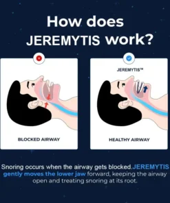 JEREMYTIS™ Adjustable Anti-Snoring Mouthpiece