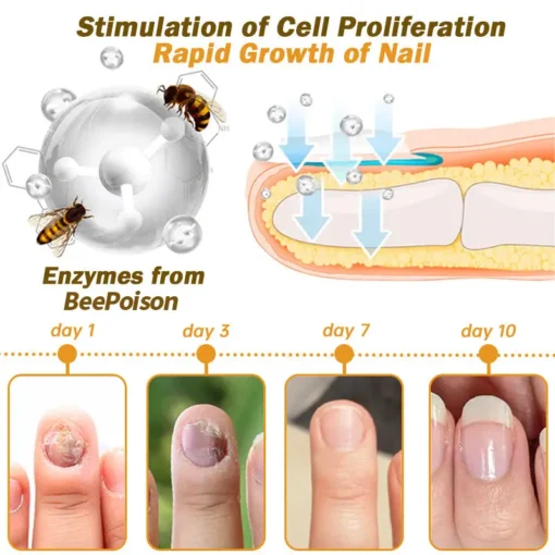 LOVILDS™ Nail Fungus Bee Poison Treatment Serum