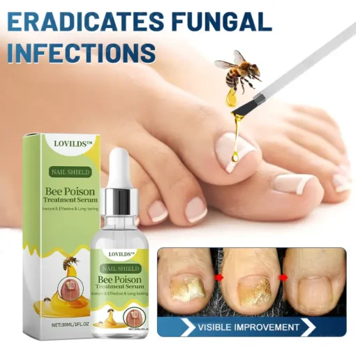 LOVILDS™ Nail Fungus Bee Poison Treatment Serum