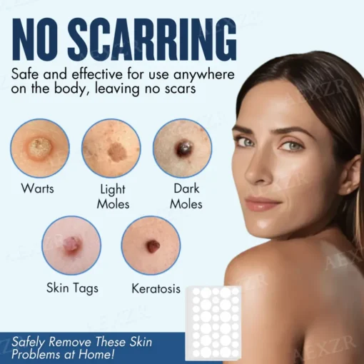 Skinetiv™ Moles & Warts Removing Skin Tag Patch